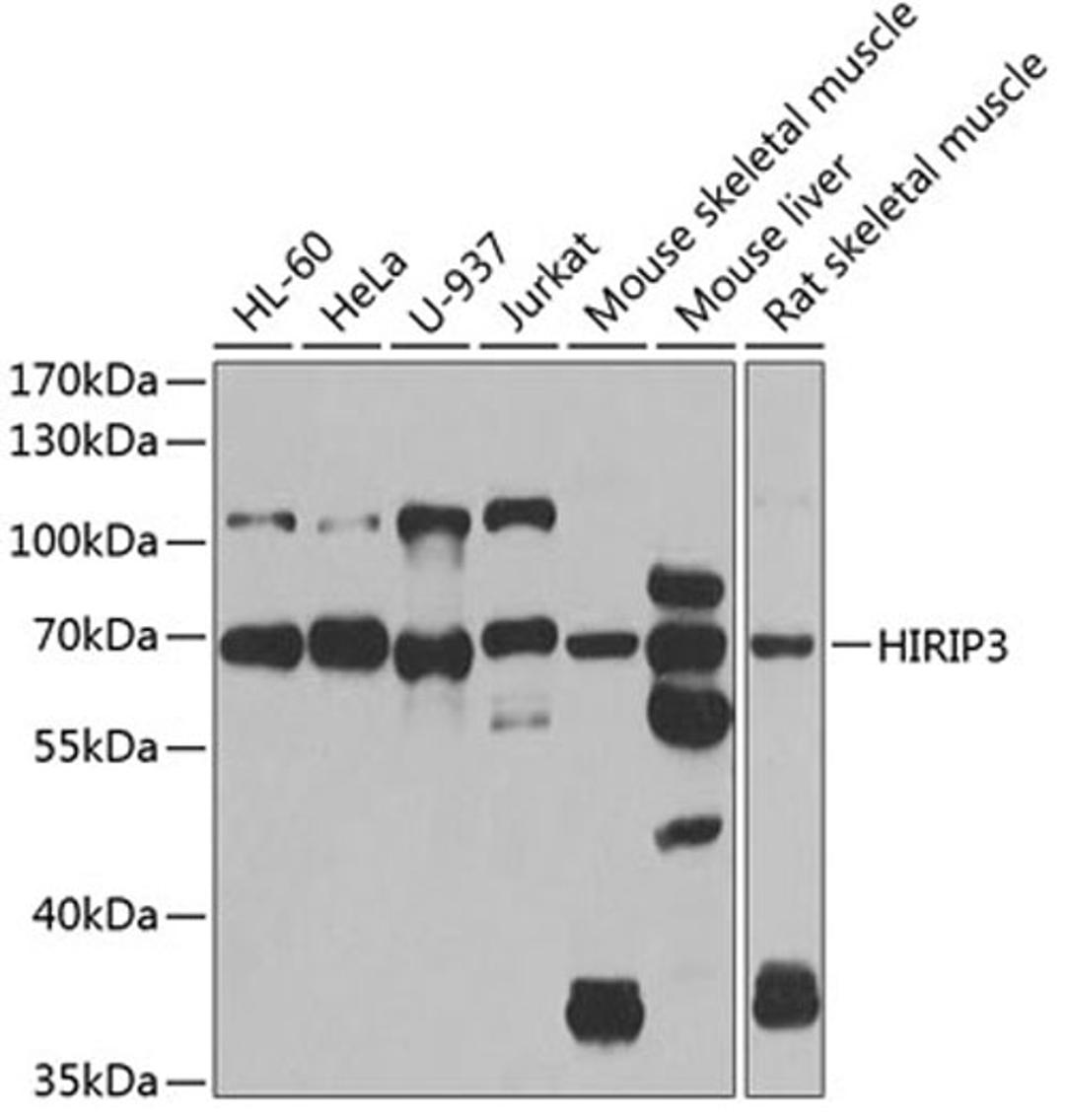 Western blot - HIRIP3 antibody (A7014)