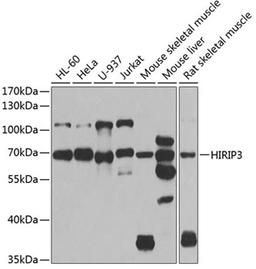 Western blot - HIRIP3 antibody (A7014)