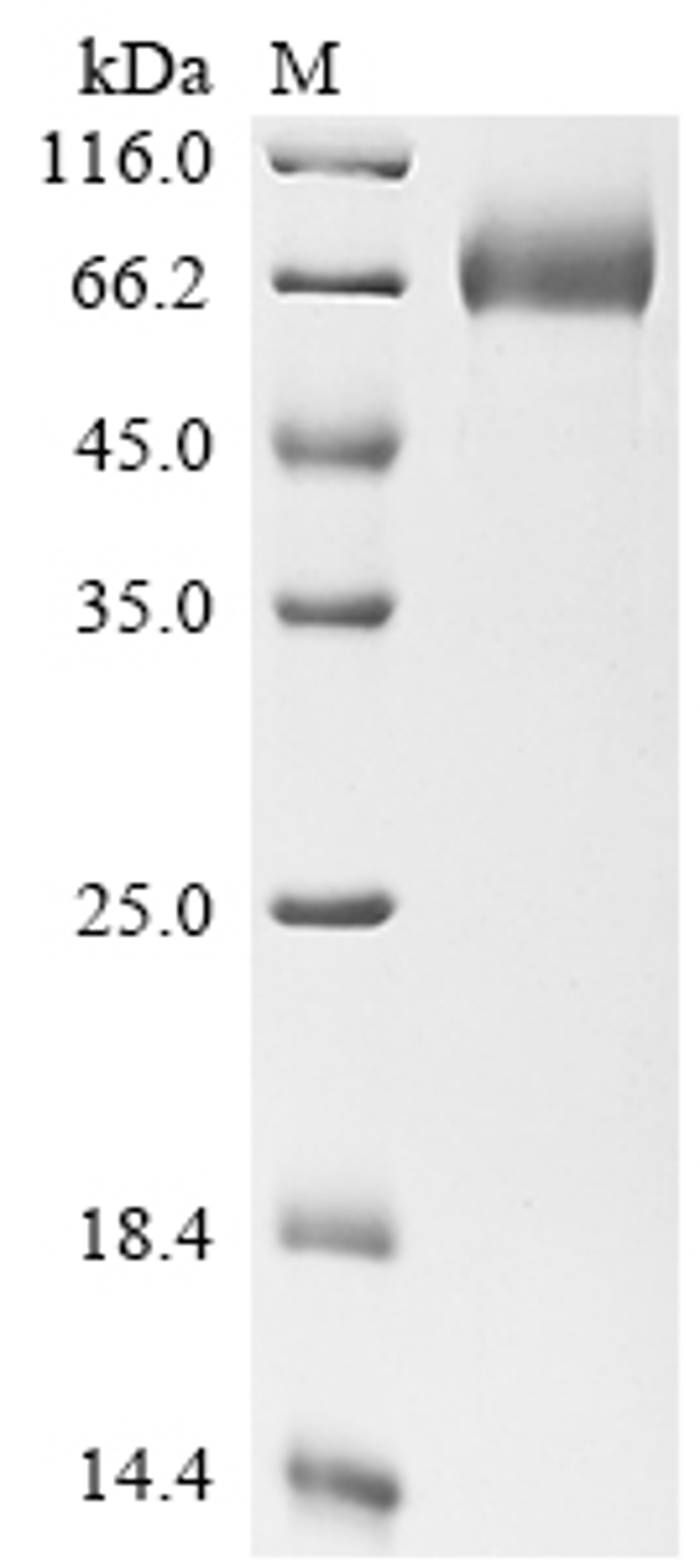 (Tris-Glycine gel) Discontinuous SDS-PAGE (reduced) with 5% enrichment gel and 15% separation gel.