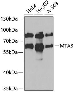 Immunohistochemistry  - MTA3 antibody (A6660)