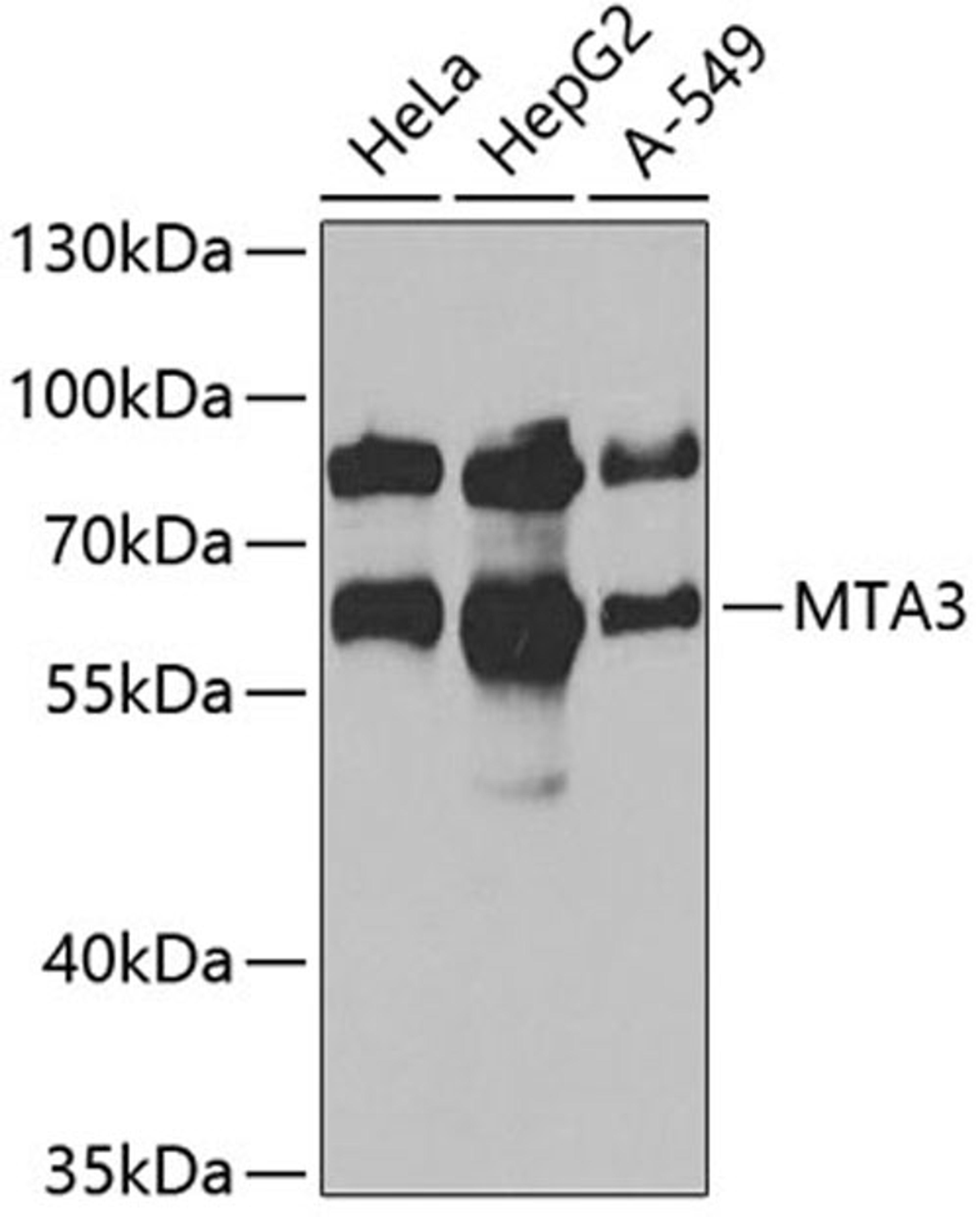 Immunohistochemistry - MTA3 antibody (A6660)
