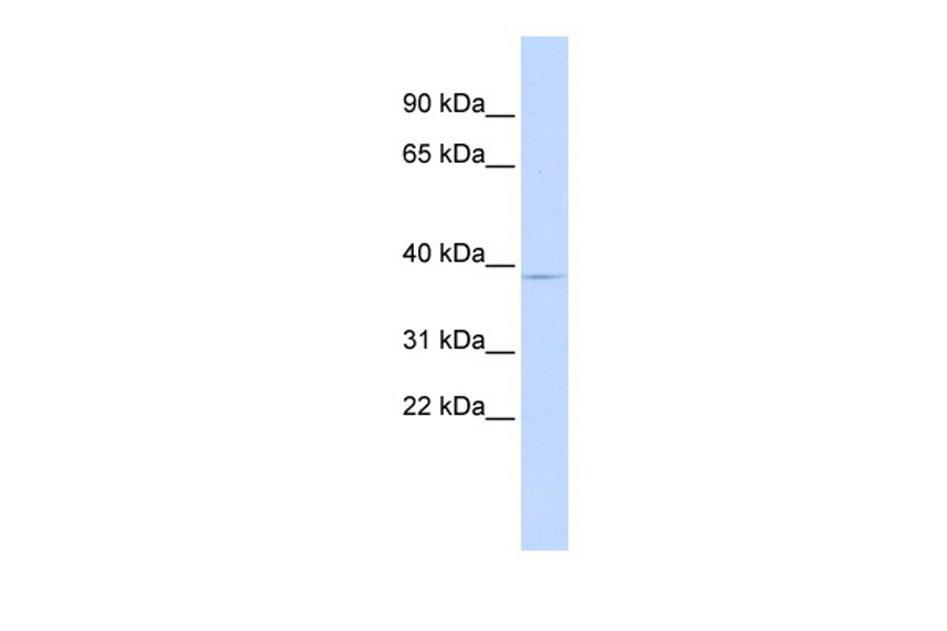 Antibody used in WB on Human Liver at 0.2-1 ug/ml.