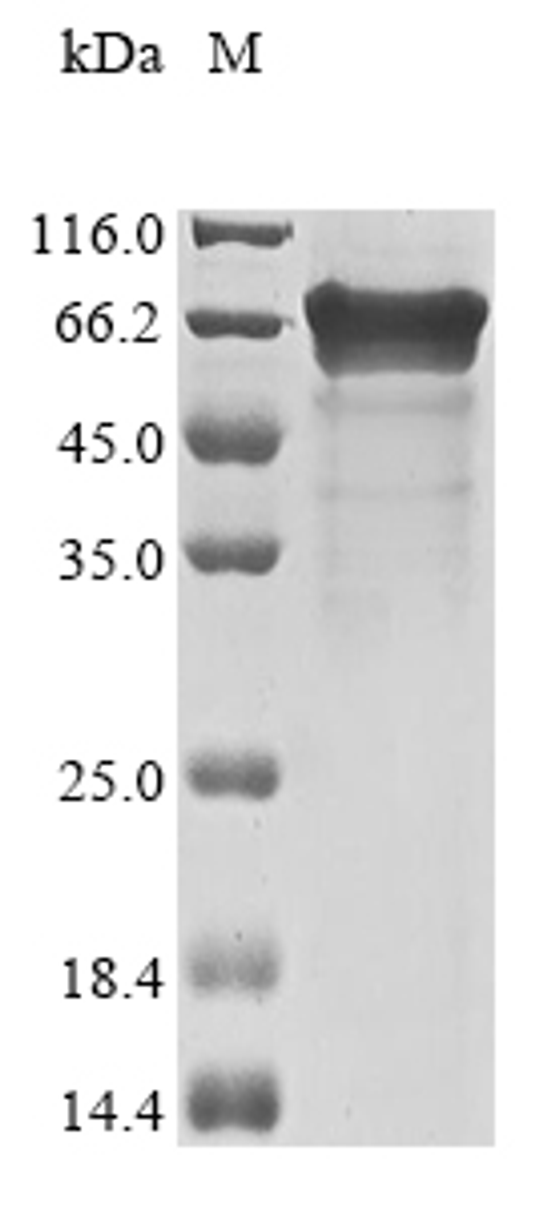 (Tris-Glycine gel) Discontinuous SDS-PAGE (reduced) with 5% enrichment gel and 15% separation gel.