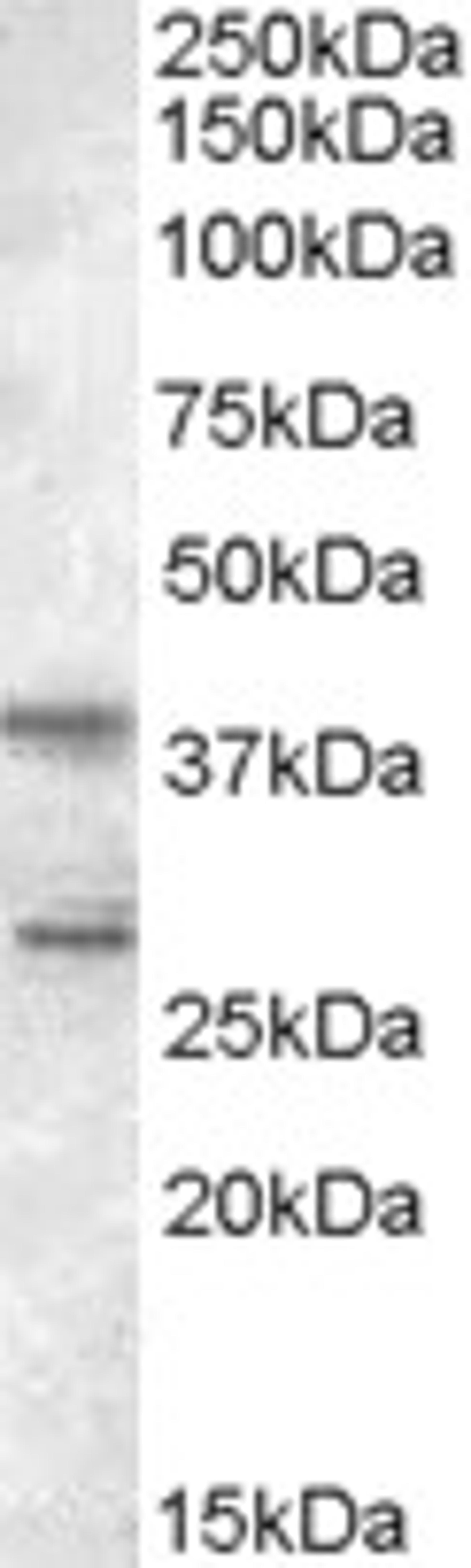 46-341 (0.5ug/ml) staining of Jurkat lysate (35ug protein in RIPA buffer). Primary incubation was 1 hour. Detected by chemiluminescence.