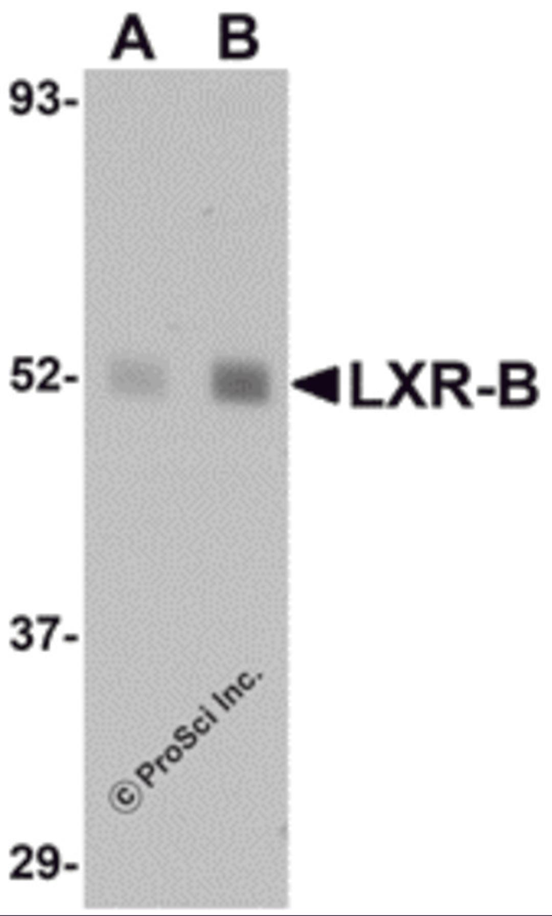 Western blot analysis of LXR-B in human lung tissue lysate with LXR-B antibody at (A) 1 and (B) 2 μg/mL.