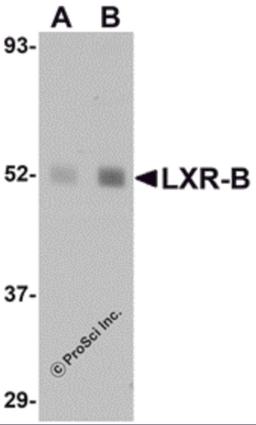 Western blot analysis of LXR-B in human lung tissue lysate with LXR-B antibody at (A) 1 and (B) 2 μg/mL.