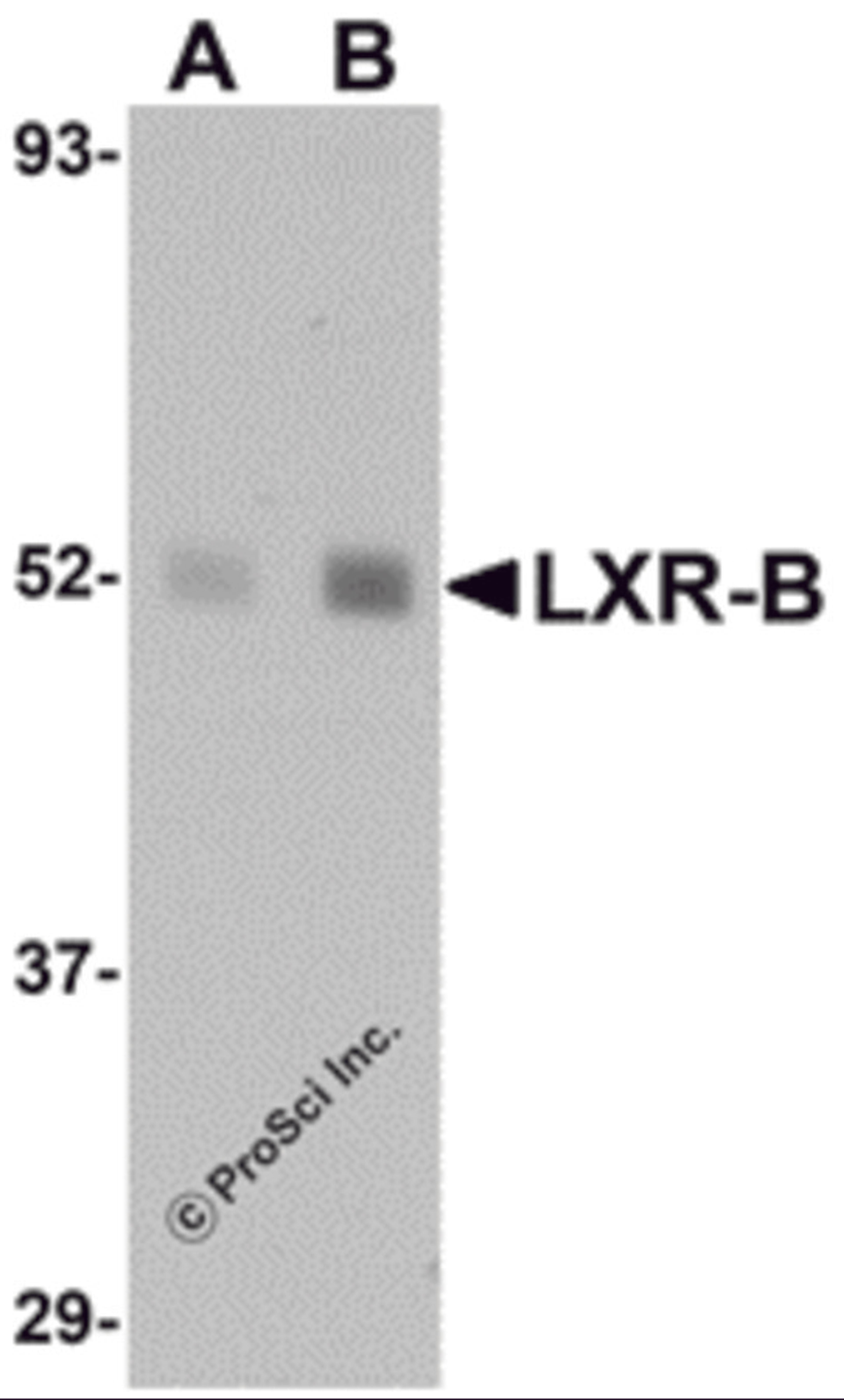 Western blot analysis of LXR-B in human lung tissue lysate with LXR-B antibody at (A) 1 and (B) 2 μg/mL.