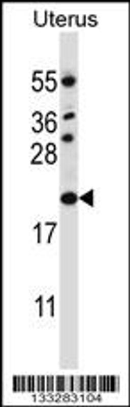 Western blot analysis in human normal Uterus tissue lysates (35ug/lane).