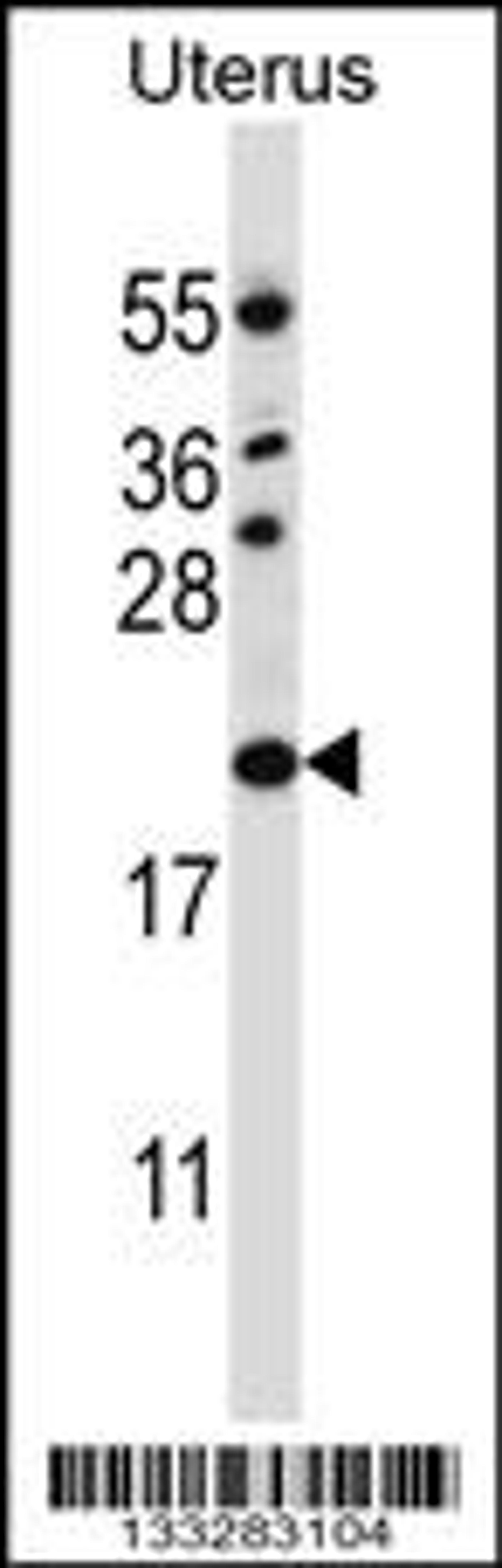 Western blot analysis in human normal Uterus tissue lysates (35ug/lane).