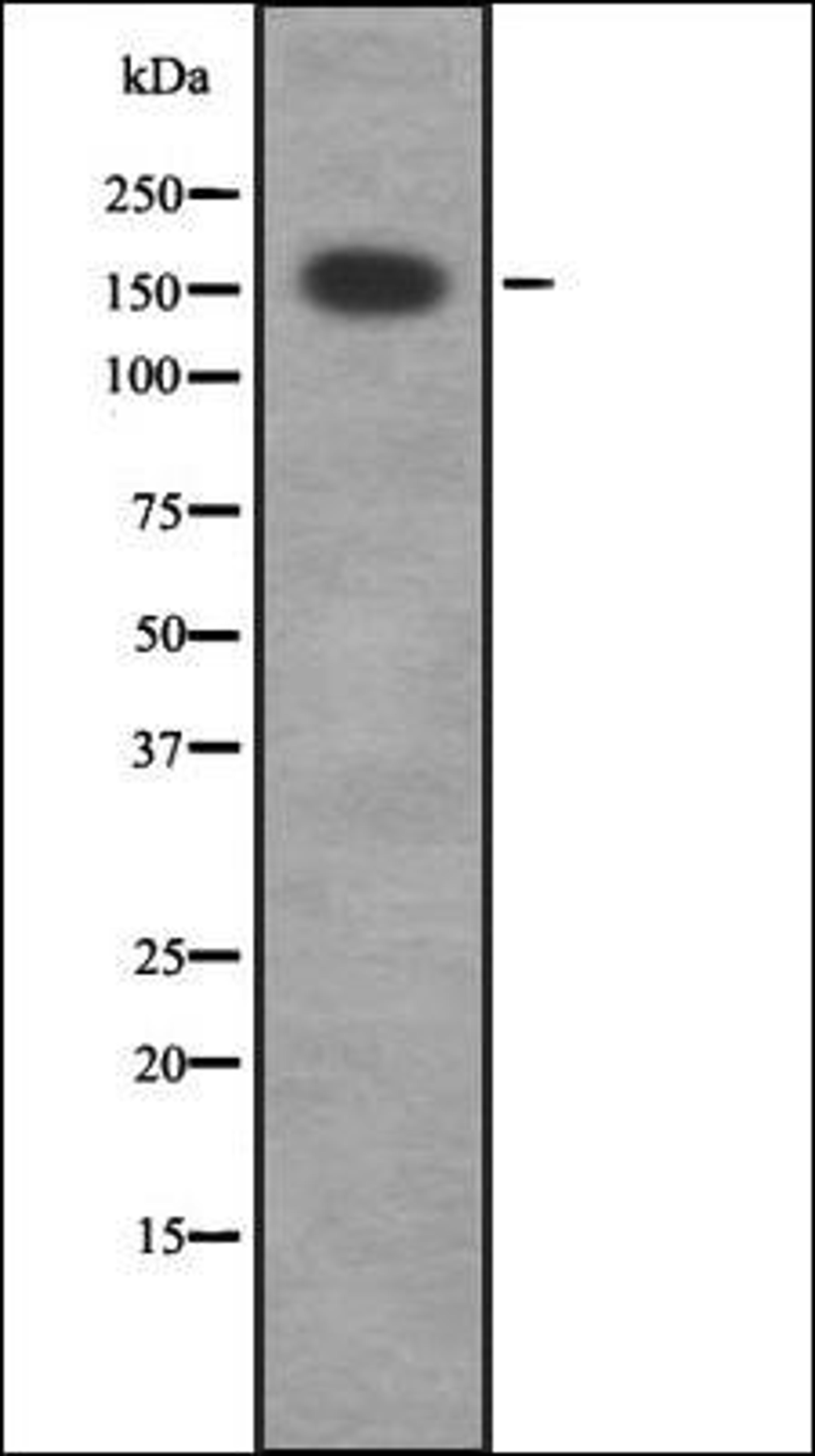 Western blot analysis of HEK293 cells using MRCKG antibody