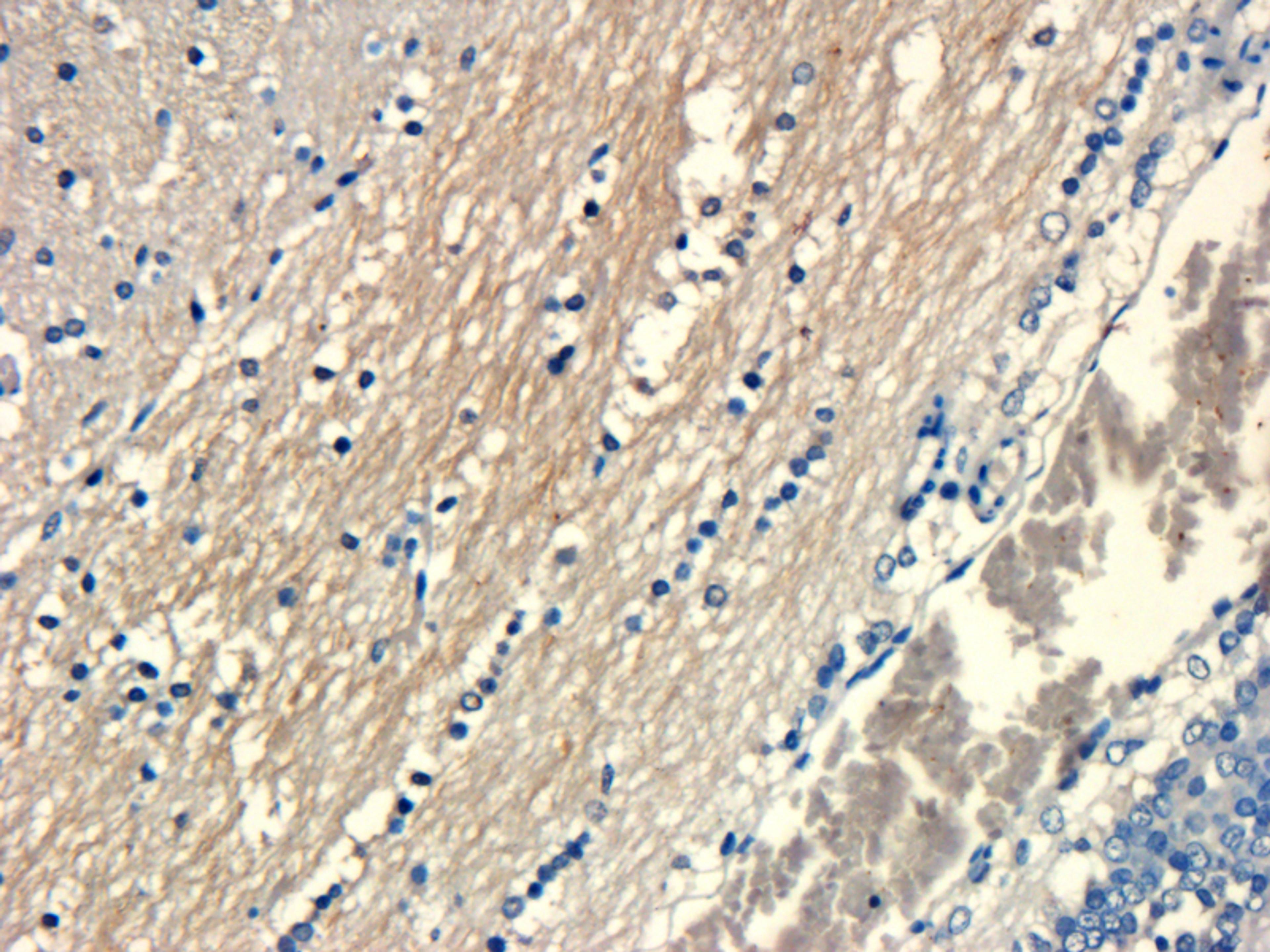 Immunohistochemical staining of paraffin embedded rat brain tissue using anti-HMGCR (phospho-Ser872) (primary antibody at 1:50)