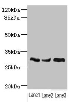 Western blot. All lanes: NDUFS3 antibody at 1.98ug/ml. Lane 1: Mouse brain tissue. Lane 2: Mouse skeletal muscle tissue. Lane 3: Mouse heart tissue. Secondary. Goat polyclonal to rabbit IgG at 1/10000 dilution. Predicted band size: 31, 15 kDa. Observed band size: 31 kDa. 