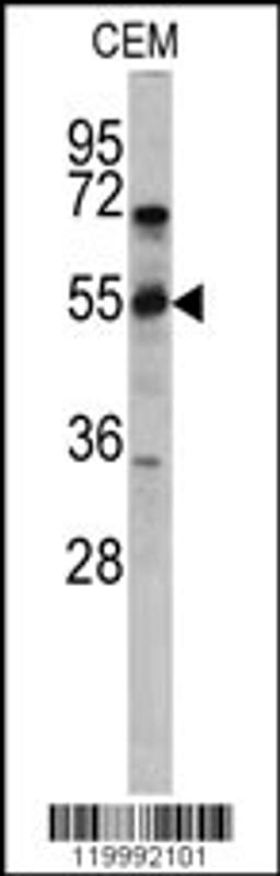 Western blot analysis of CD36 antibody in CEM cell line lysates (35ug/lane)