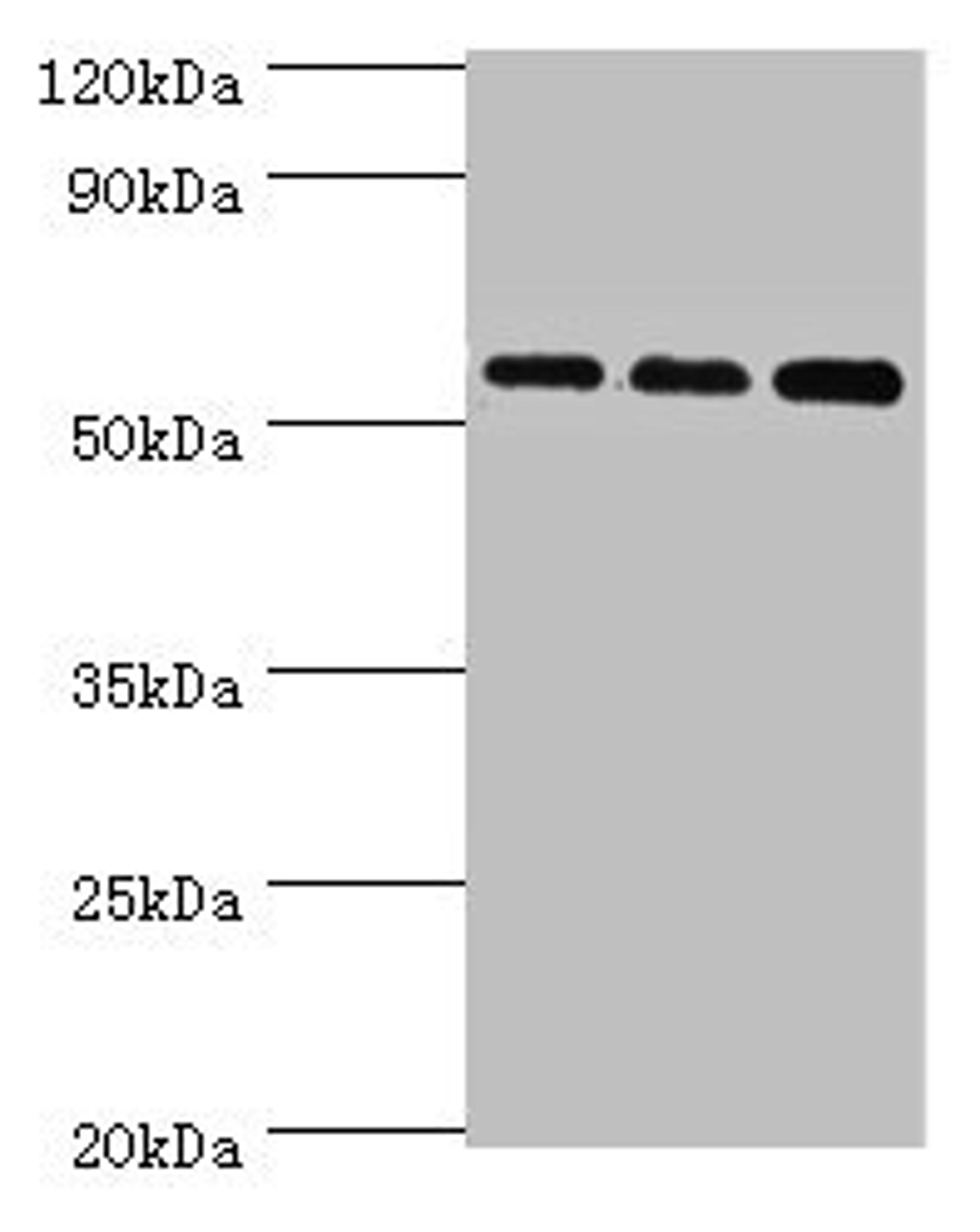 Western blot. All lanes: Acyl-coenzyme A synthetase ACSM3, mitochondrial antibody at 10ug/ml. Lane 1: 293T whole cell lysate. Lane 2: Mouse kidney tissue. Lane 3: A431 whole cell lysate. Secondary. Goat polyclonal to rabbit IgG at 1/10000 dilution. Predicted band size: 67, 50 kDa. Observed band size: 67 kDa. 