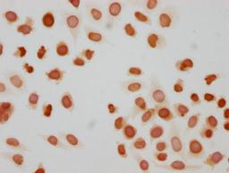 Immunocytochemistry analysis of CSB-PA010377OA172phHU diluted at 1:10 and staining in Hela cells(treated with 50nM Calyculin A for 30min) performed on a Leica BondTM system. The cells were fixed in 4% formaldehyde, permeabilized using 0.2% Triton X-100 and blocked with 10% normal goat serum 30min at RT. Then primary antibody (1% BSA) was incubated at 4°C overnight. The primary is detected by a biotinylated secondary antibody and visualized using an HRP conjugated SP system.