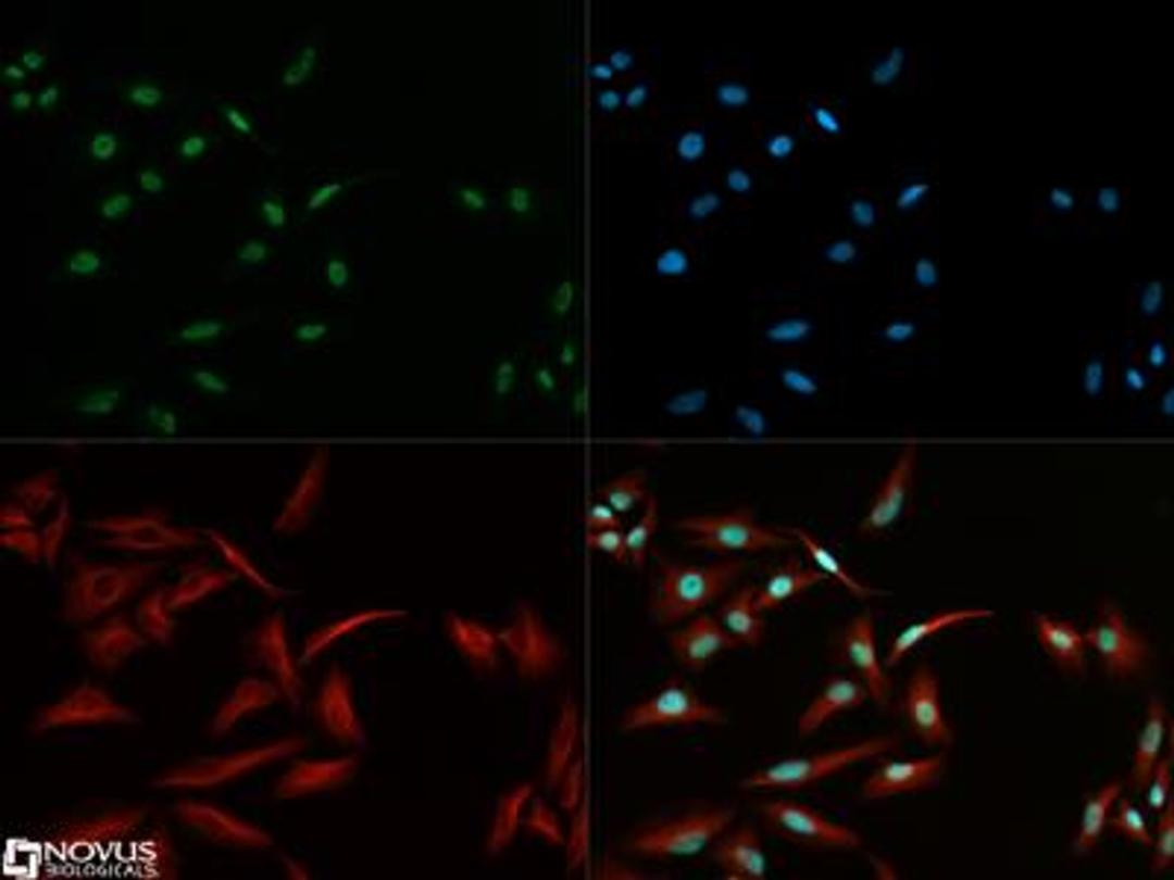 Immunocytochemistry/Immunofluorescence: Shugoshin Antibody [NBP1-03361] - Shugoshin antibody was tested in HeLa cells with DyLight 488 (green). Nuclei and alpha-tubulin were counterstained with DAPI (blue) and Dylight 550 (red).