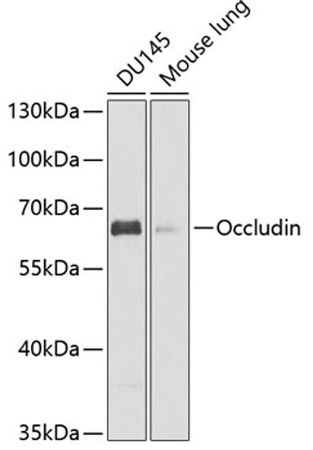 Western blot - Occludin antibody (A12621)