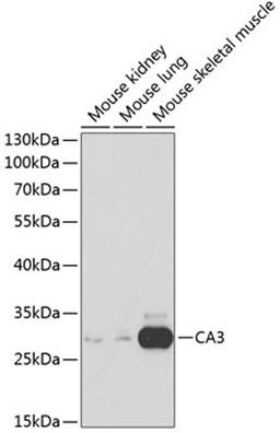 Western blot - CA3 antibody (A1212)