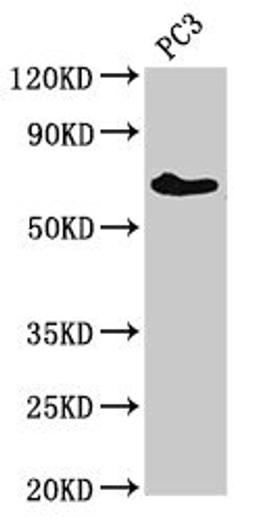 Western Blot. Positive WB detected in: PC-3 whole cell lysate. All lanes: ICK antibody at 3ug/ml. Secondary. Goat polyclonal to rabbit IgG at 1/50000 dilution. Predicted band size: 72, 35 kDa. Observed band size: 72 kDa. 