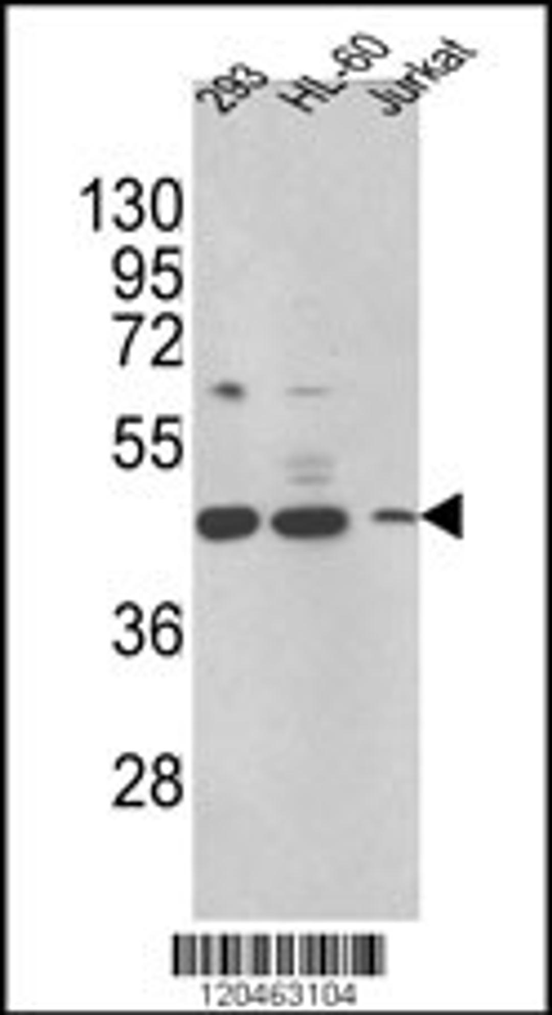 Western blot analysis of HSD17B7 Antibody in 293,HL-60,Jurkat cell line lysates (35ug/lane)(2ug/ml)