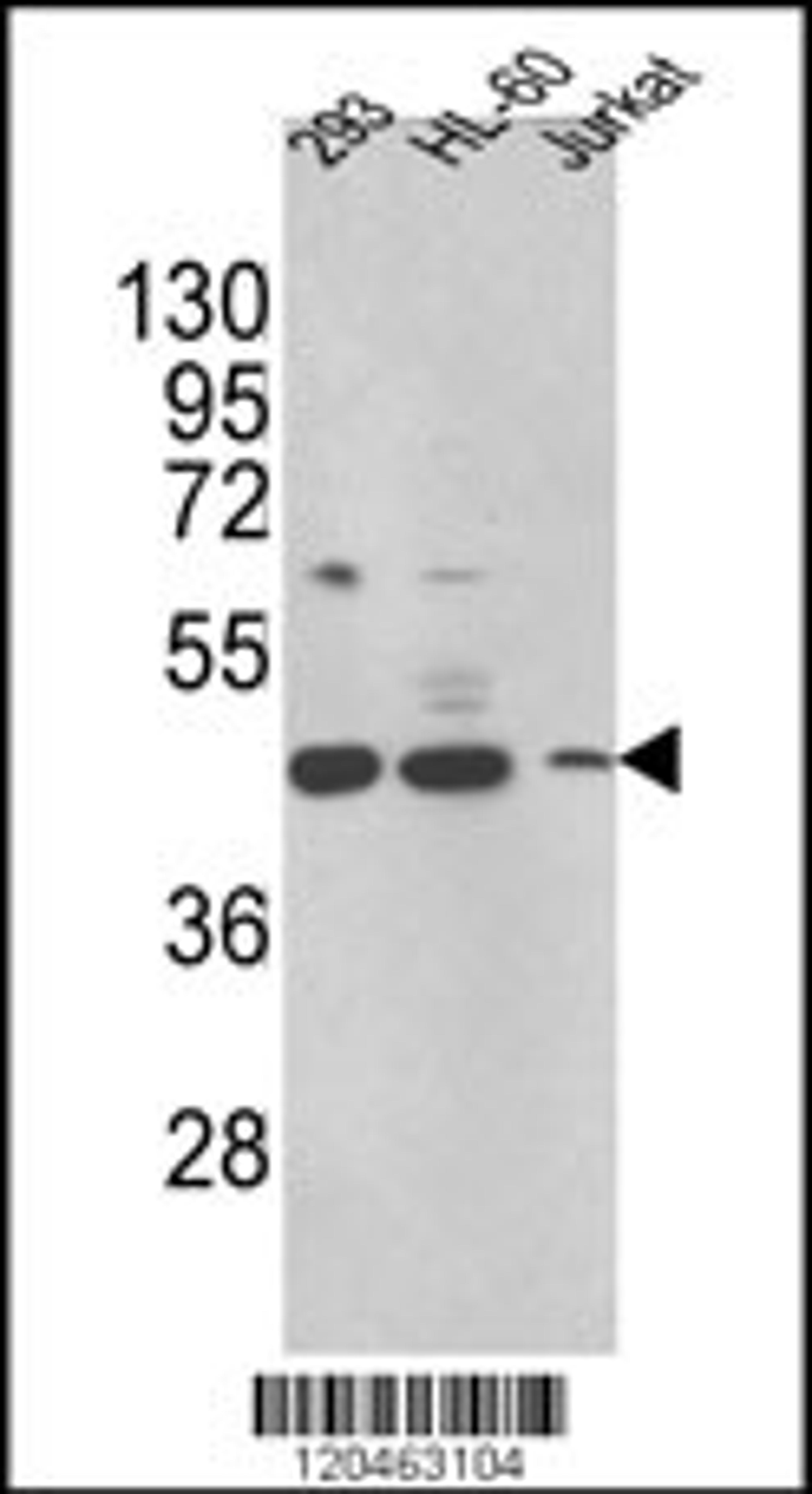 Western blot analysis of HSD17B7 Antibody in 293,HL-60,Jurkat cell line lysates (35ug/lane)(2ug/ml)