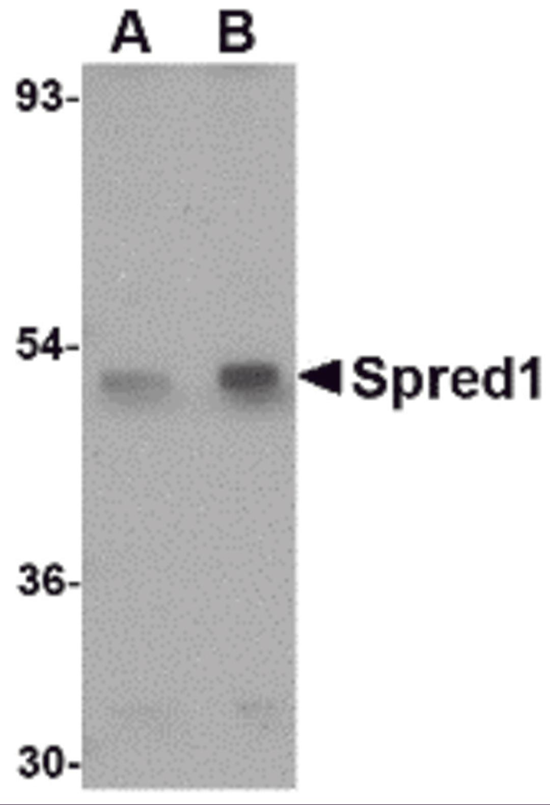 Western blot analysis of Spred1 in mouse brain tissue lysate with Spred1 antibody at (A) 1 and (B) 2 &#956;g/mL.