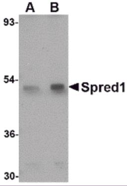 Western blot analysis of Spred1 in mouse brain tissue lysate with Spred1 antibody at (A) 1 and (B) 2 &#956;g/mL.