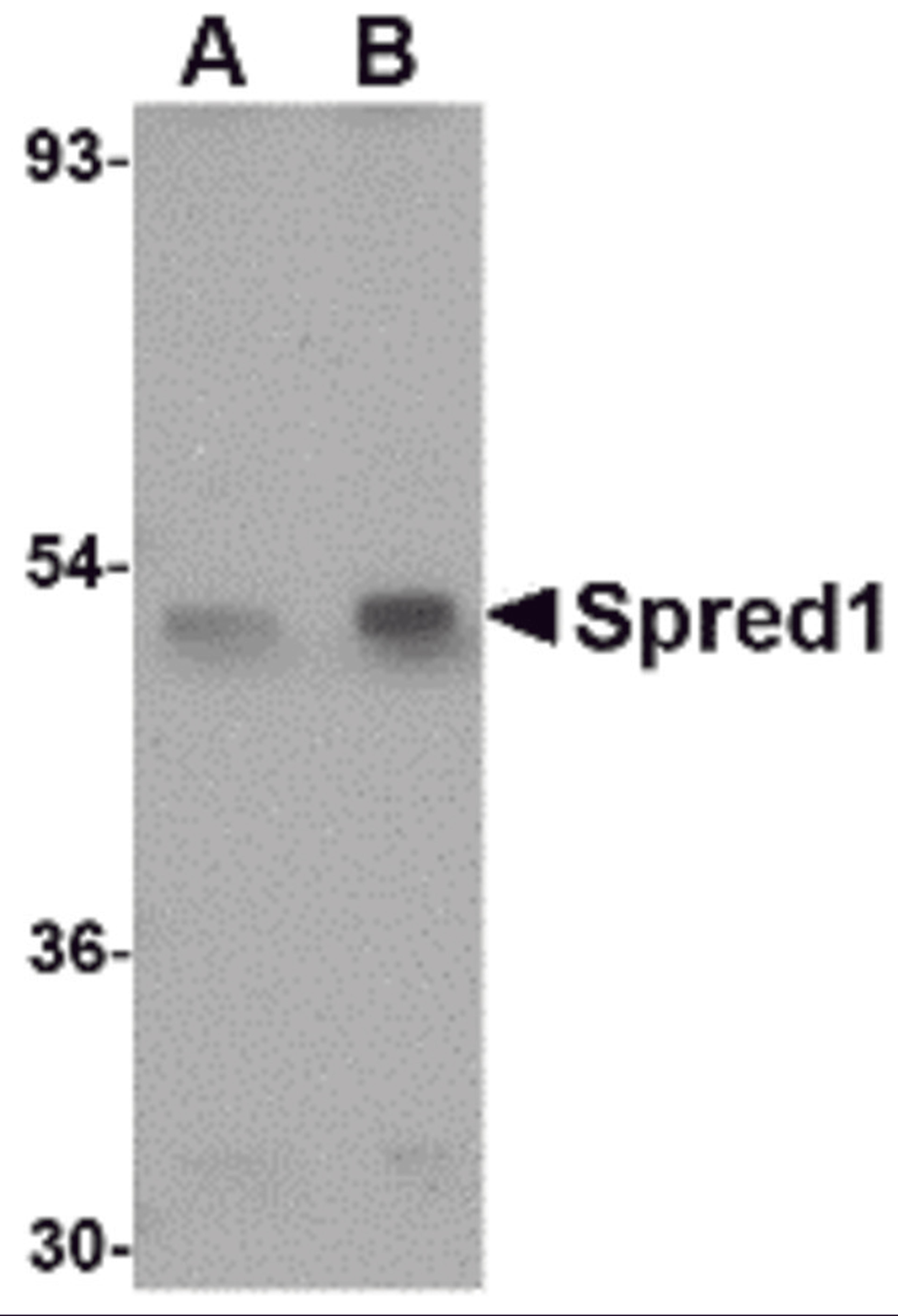 Western blot analysis of Spred1 in mouse brain tissue lysate with Spred1 antibody at (A) 1 and (B) 2 &#956;g/mL.