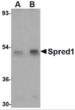 Western blot analysis of Spred1 in mouse brain tissue lysate with Spred1 antibody at (A) 1 and (B) 2 μg/mL.