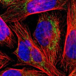 Immunocytochemistry/Immunofluorescence: FBPase 1 Antibody [NBP1-84721] - - Staining of human cell line U-2 OS shows positivity in mitochondria.