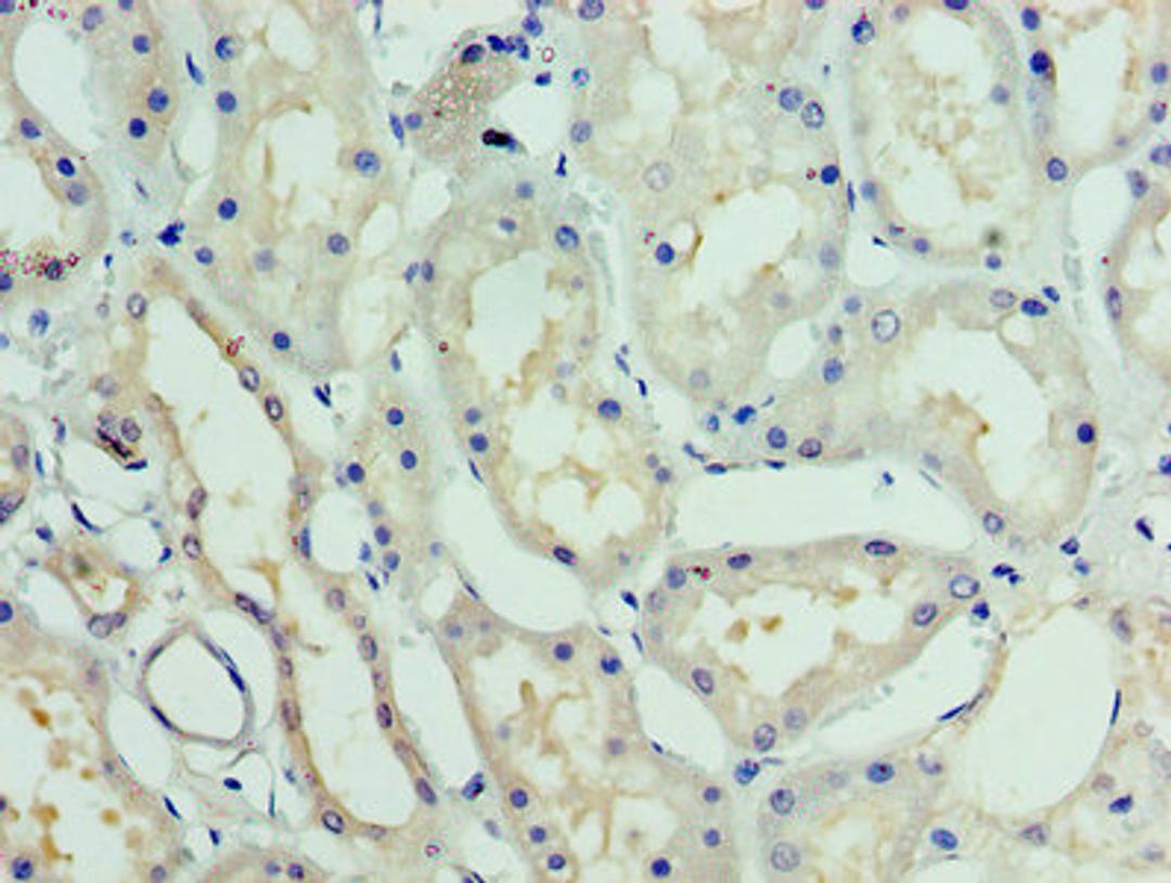 Immunohistochemistry of paraffin-embedded human kidney tissue using CSB-PA010014EA01HU at dilution of 1:100