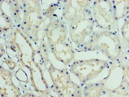 Immunohistochemistry of paraffin-embedded human kidney tissue using CSB-PA010014EA01HU at dilution of 1:100