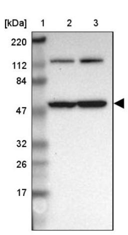 Western Blot: TCP1-beta Antibody [NBP1-88146] - Lane 1: Marker [kDa] 220, 112, 84, 47, 32, 26, 17<br/>Lane 2: Human cell line RT-4<br/>Lane 3: Human cell line U-251MG sp