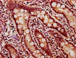IHC image of CSB-PA010403OA11nacHU diluted at 1:20 and staining in paraffin-embedded human small intestine tissue performed on a Leica BondTM system. After dewaxing and hydration, antigen retrieval was mediated by high pressure in a citrate buffer (pH 6.0). Section was blocked with 10% normal goat serum 30min at RT. Then primary antibody (1% BSA) was incubated at 4°C overnight. The primary is detected by a biotinylated secondary antibody and visualized using an HRP conjugated SP system.