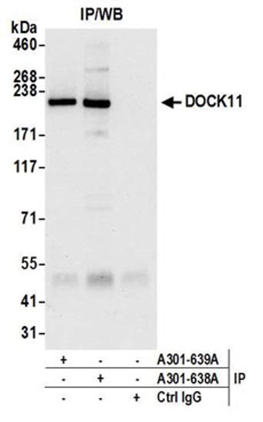 Detection of human DOCK11 by western blot of immunoprecipitates.