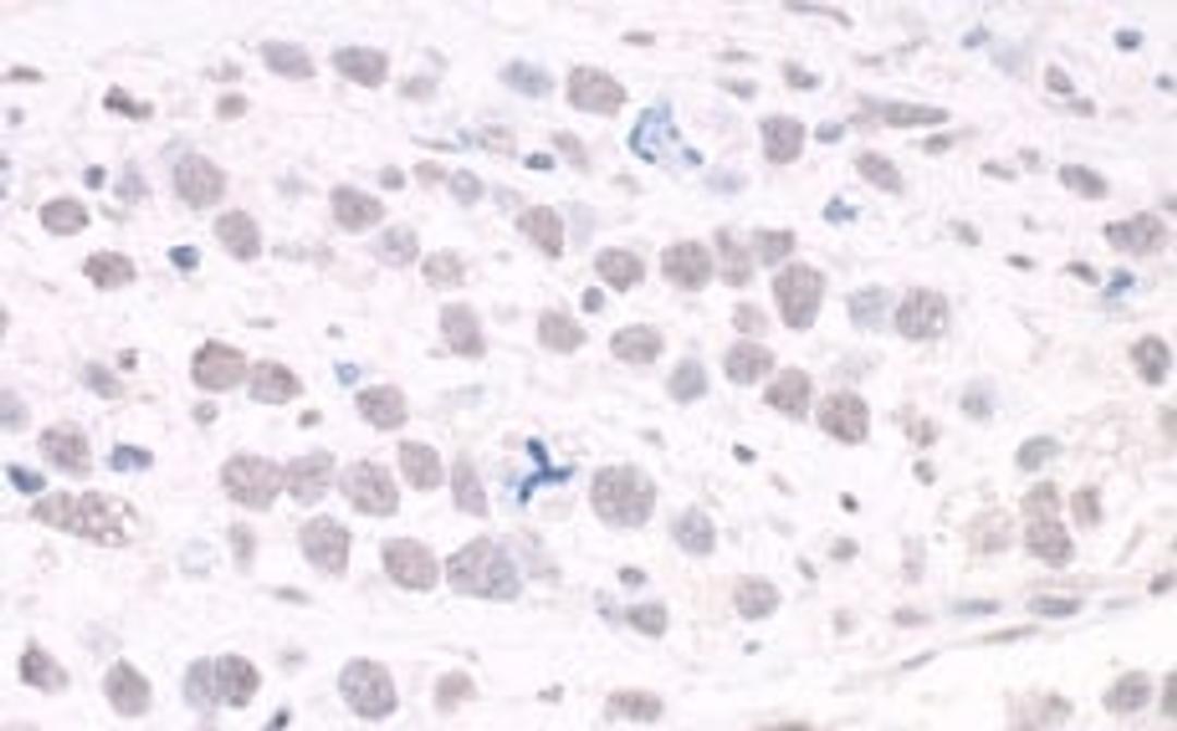 Detection of human ARID2 by immunohistochemistry.