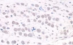 Detection of human ARID2 by immunohistochemistry.