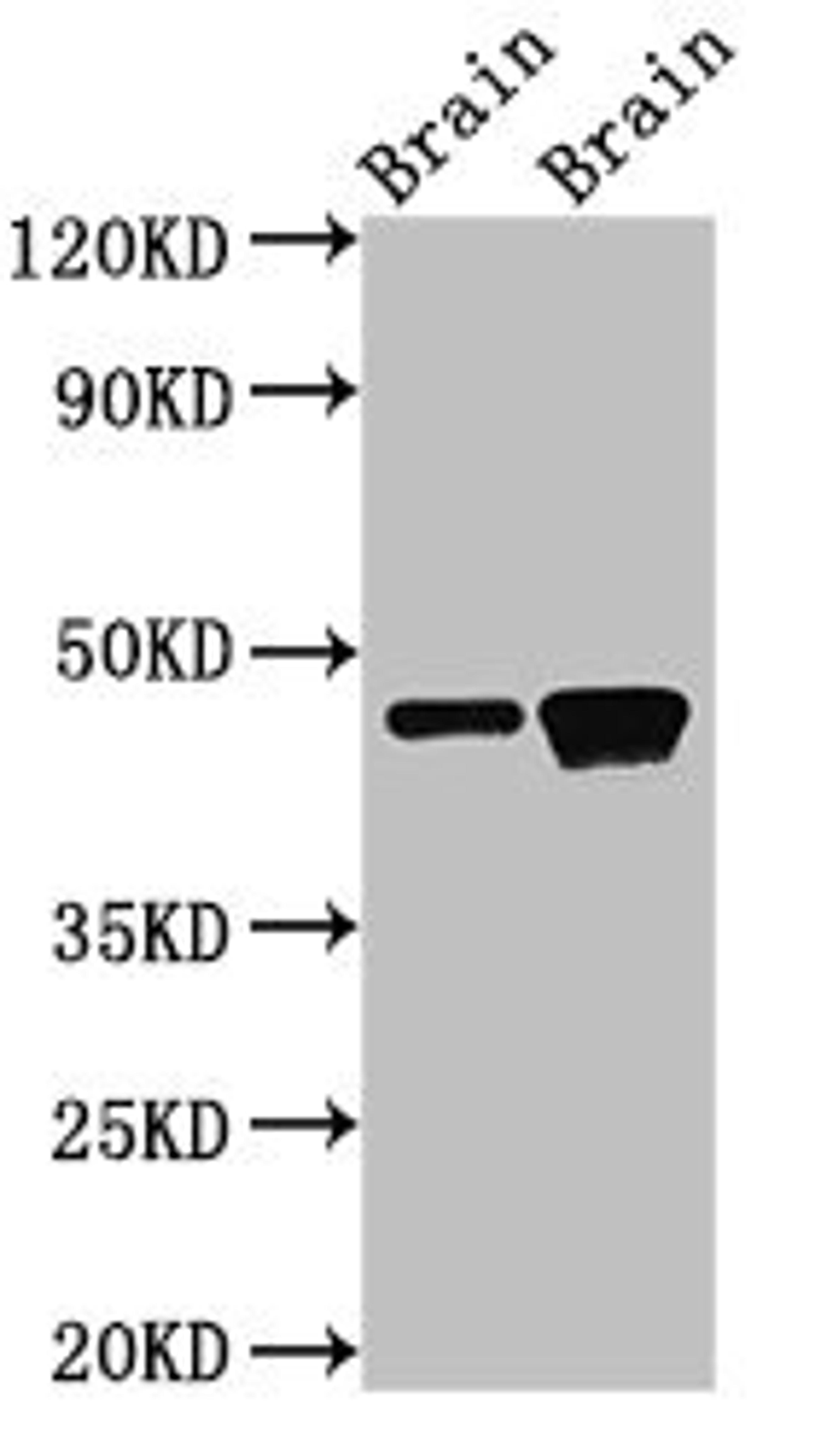 Western Blot. Positive WB detected in: Rat brain tissue, Mouse brain tissue. All lanes: GNAS antibody at 3µg/ml. Secondary. Goat polyclonal to rabbit IgG at 1/50000 dilution. Predicted band size: 46, 45, 112, 110, 78, 29 kDa. Observed band size: 46 kDa