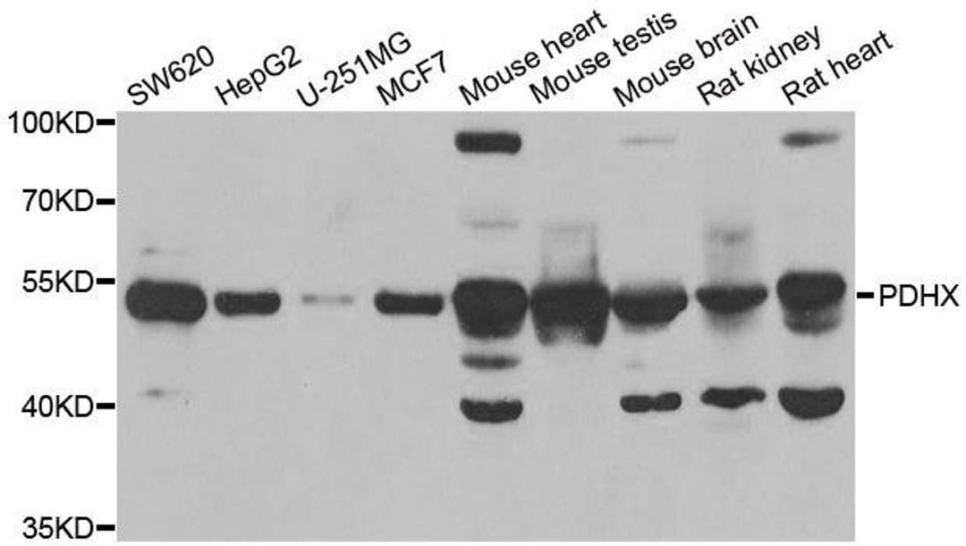 Western blot analysis of extracts of various cell lines using PDHX antibody