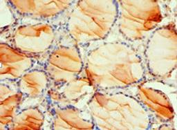 Immunohistochemistry of paraffin-embedded human thyroid tissue using CSB-PA017738ESR1HU at dilution of 1:100