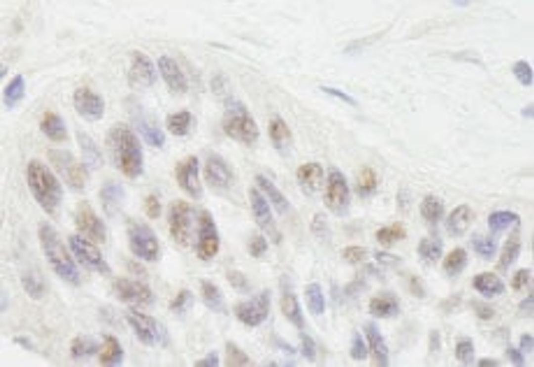 Detection of human RIF1 by immunohistochemistry.