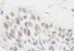 Detection of human RIF1 by immunohistochemistry.