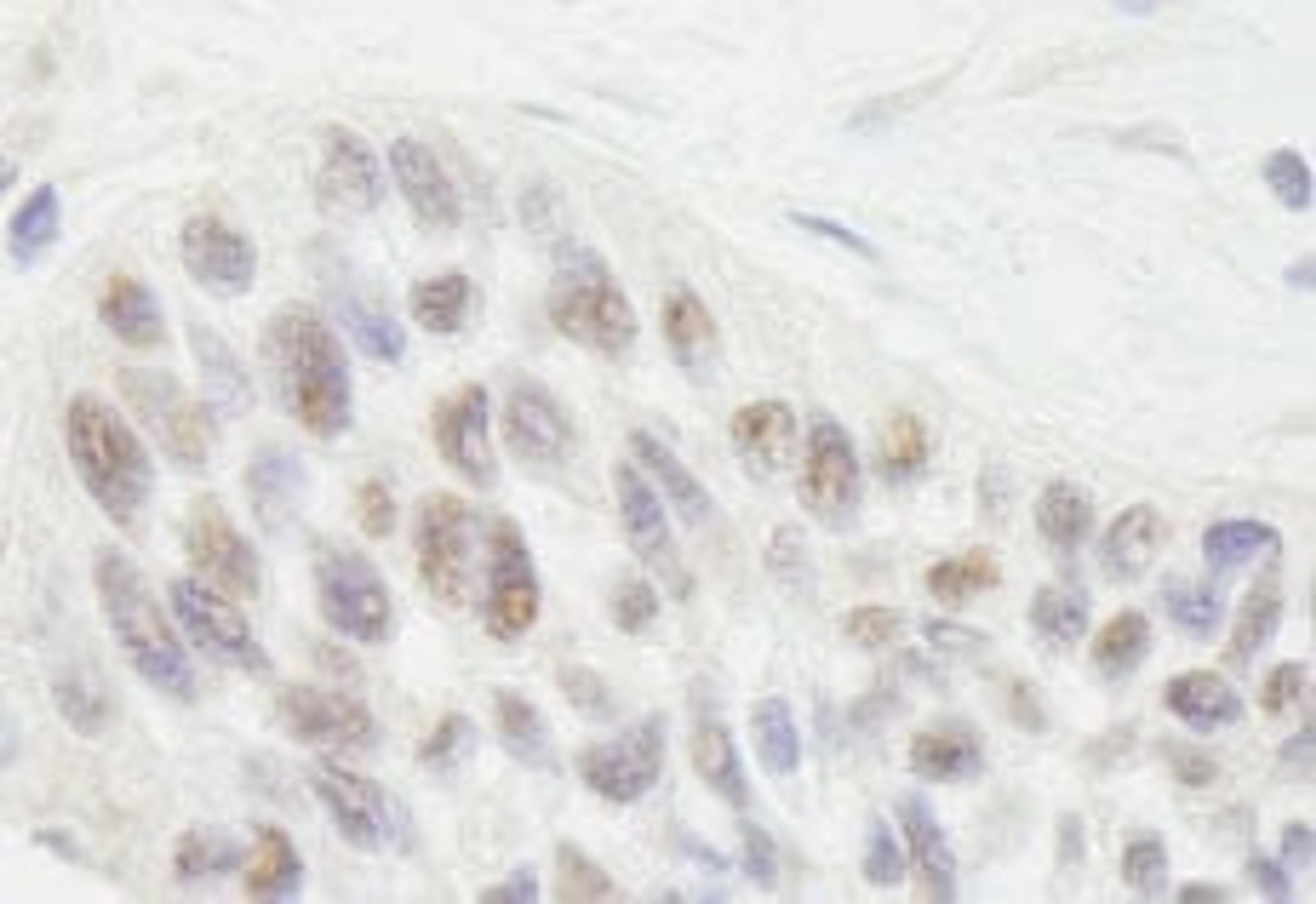 Detection of human RIF1 by immunohistochemistry.