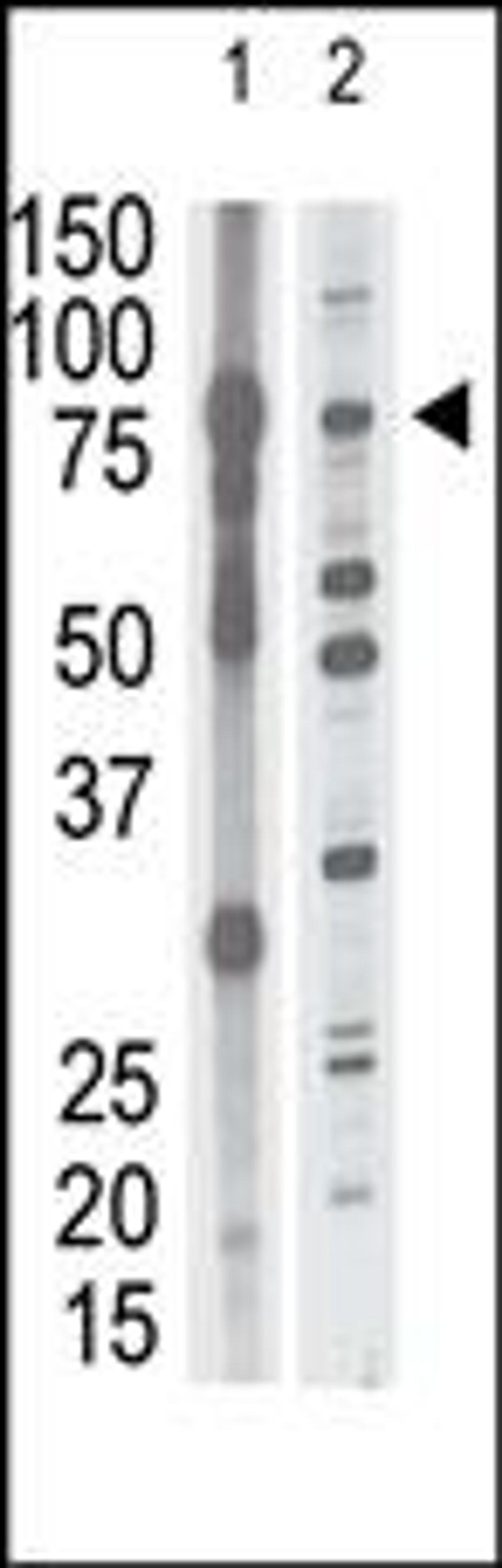 Antibody is used in Western blot to detect MMP15 in mouse brain tissue lysate (lane 1) and HL60 cell lysate (lane 2) lysate.