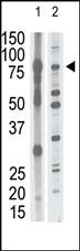 Antibody is used in Western blot to detect MMP15 in mouse brain tissue lysate (lane 1) and HL60 cell lysate (lane 2) lysate.