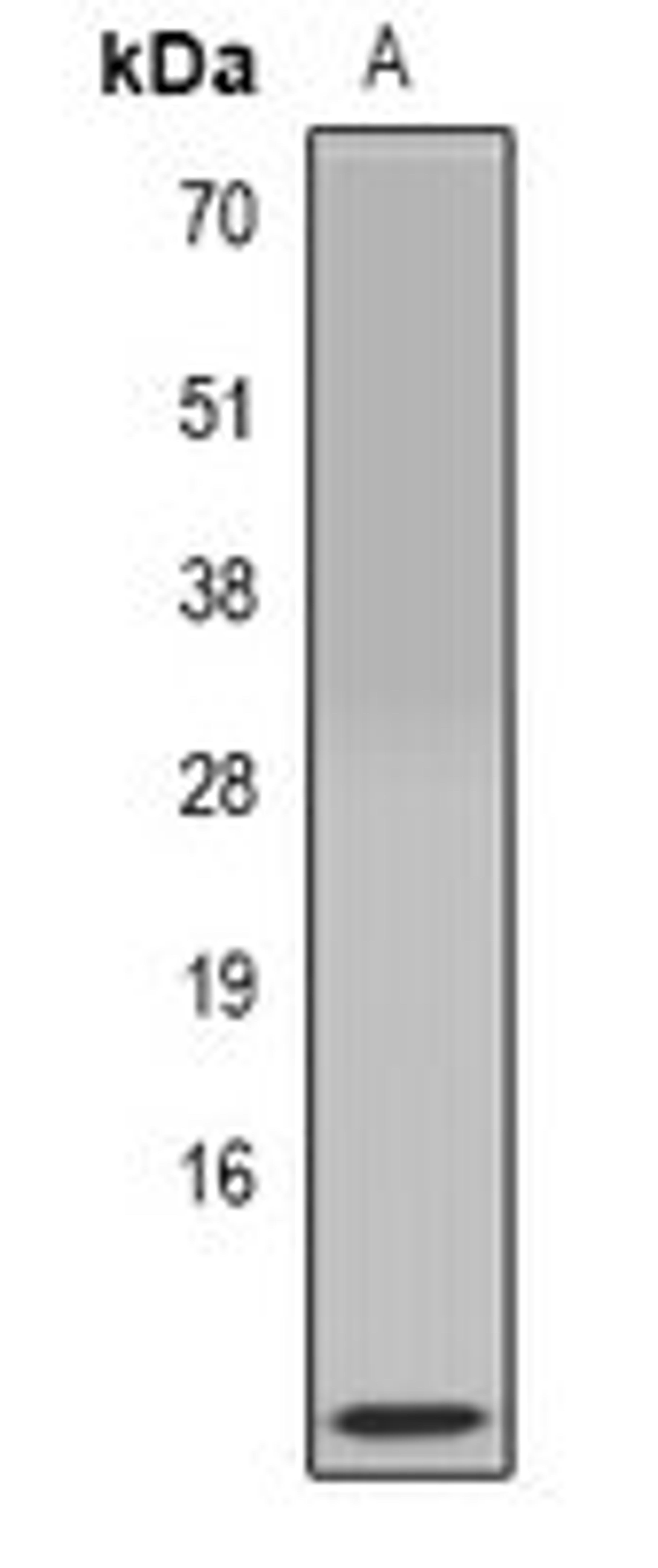 Western blot analysis of mouse pancreas (Lane1) whole cell lysates using CLPS antibody