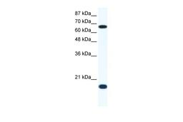 Antibody used in WB on Human Jurkat 1.25 ug/ml.