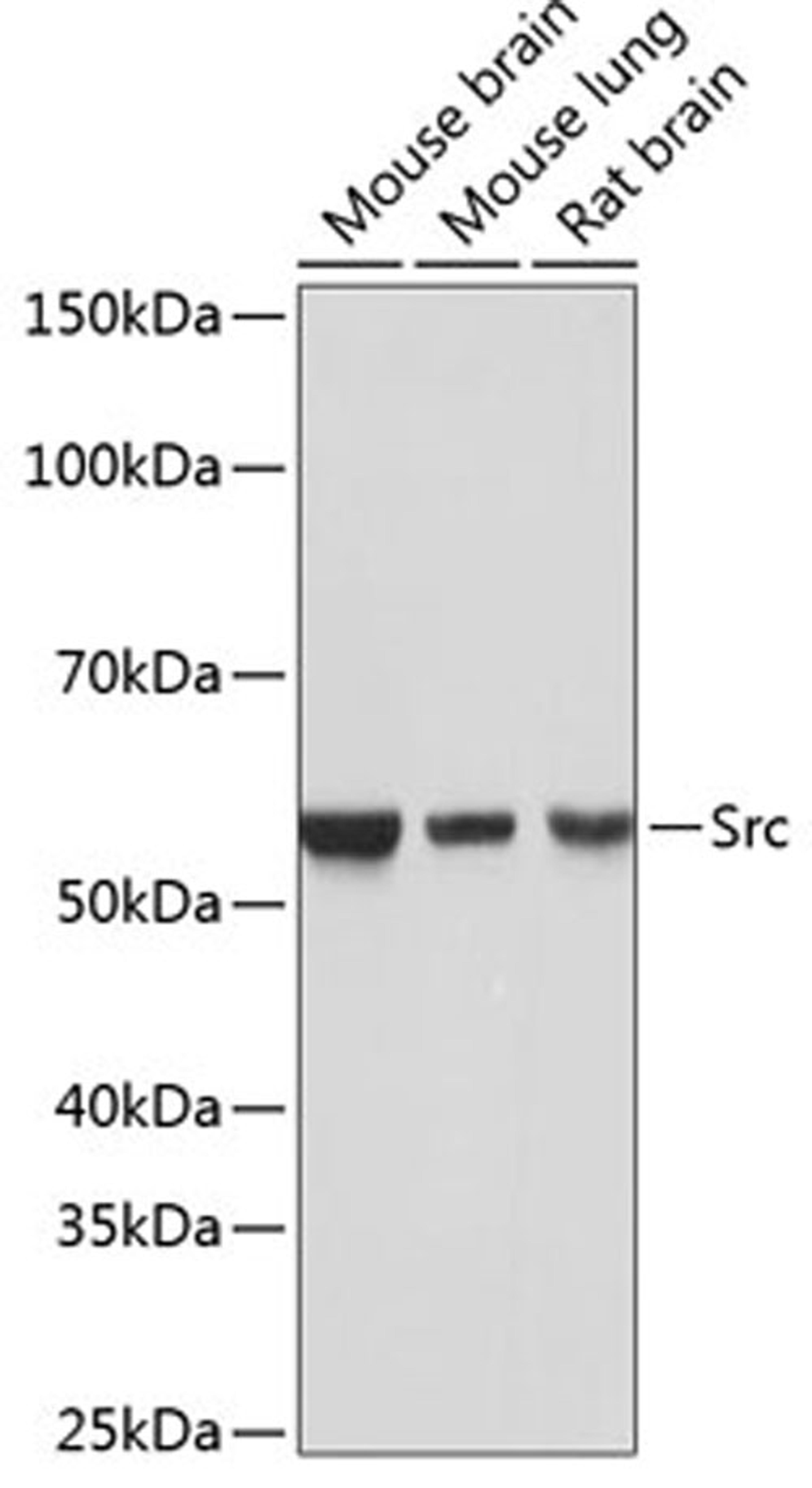 Western blot - Src antibody (A19119)