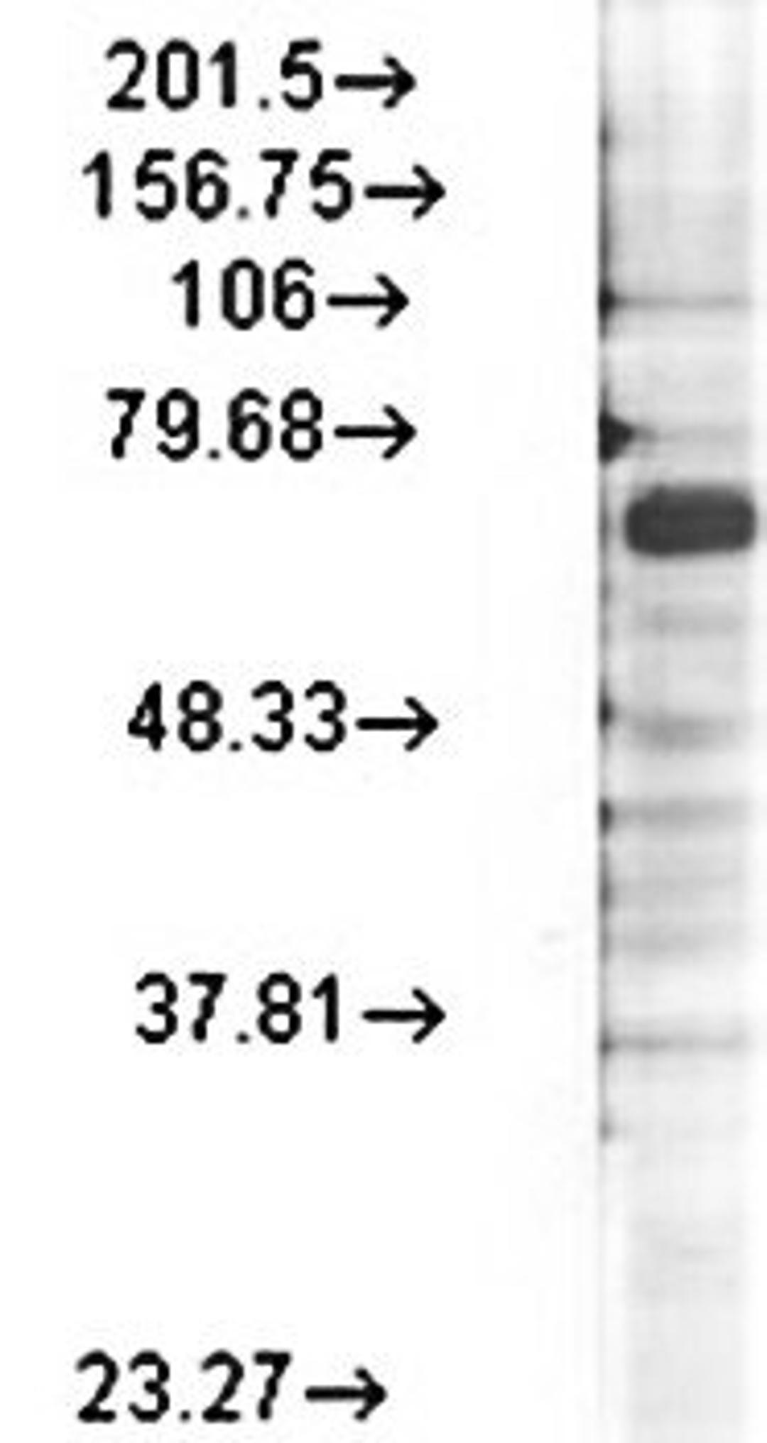 Western blot analysis of rat brain membrane lysates using Kv3.4 antibody