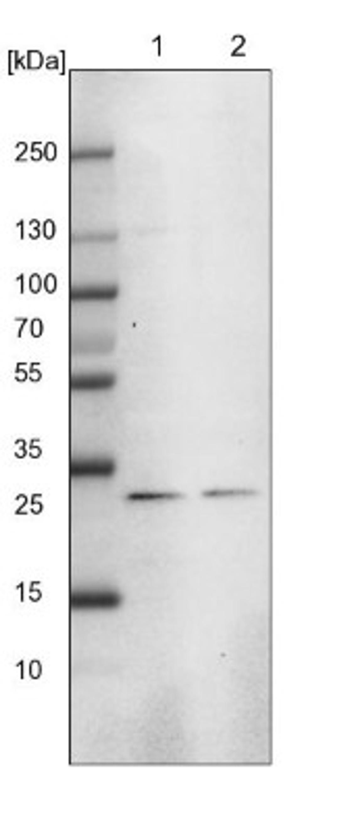 Western Blot: MED8 Antibody [NBP1-89015] - Lane 1: NIH-3T3 cell lysate (Mouse embryonic fibroblast cells)<br/>Lane 2: NBT-II cell lysate (Rat Wistar bladder tumour cells)